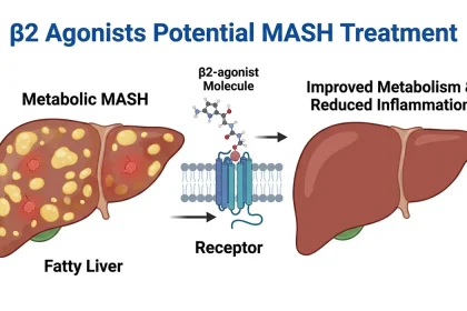 New Study Shows Beta 2 Agonists Could Treat Metabolic MASH